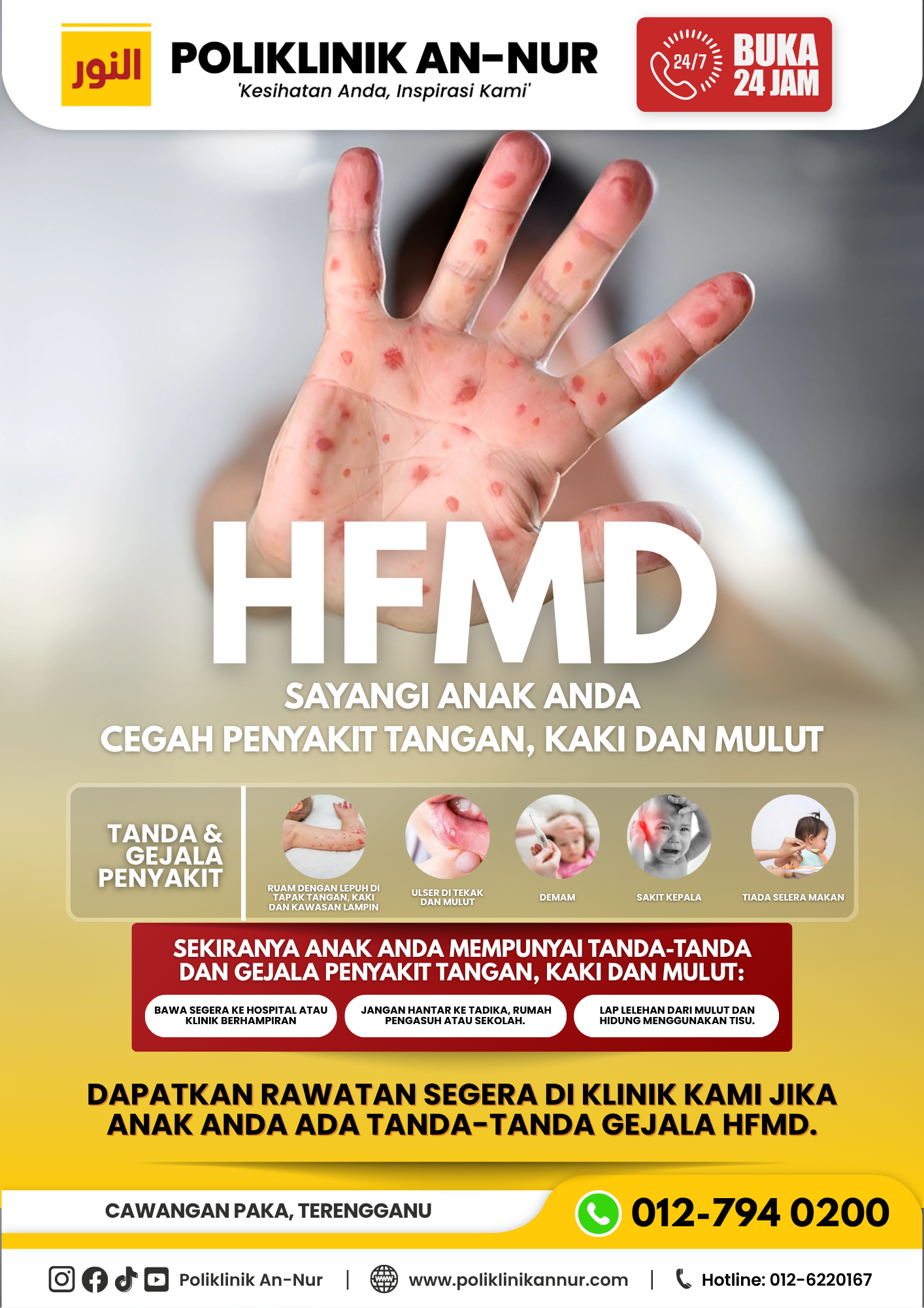 HFMD