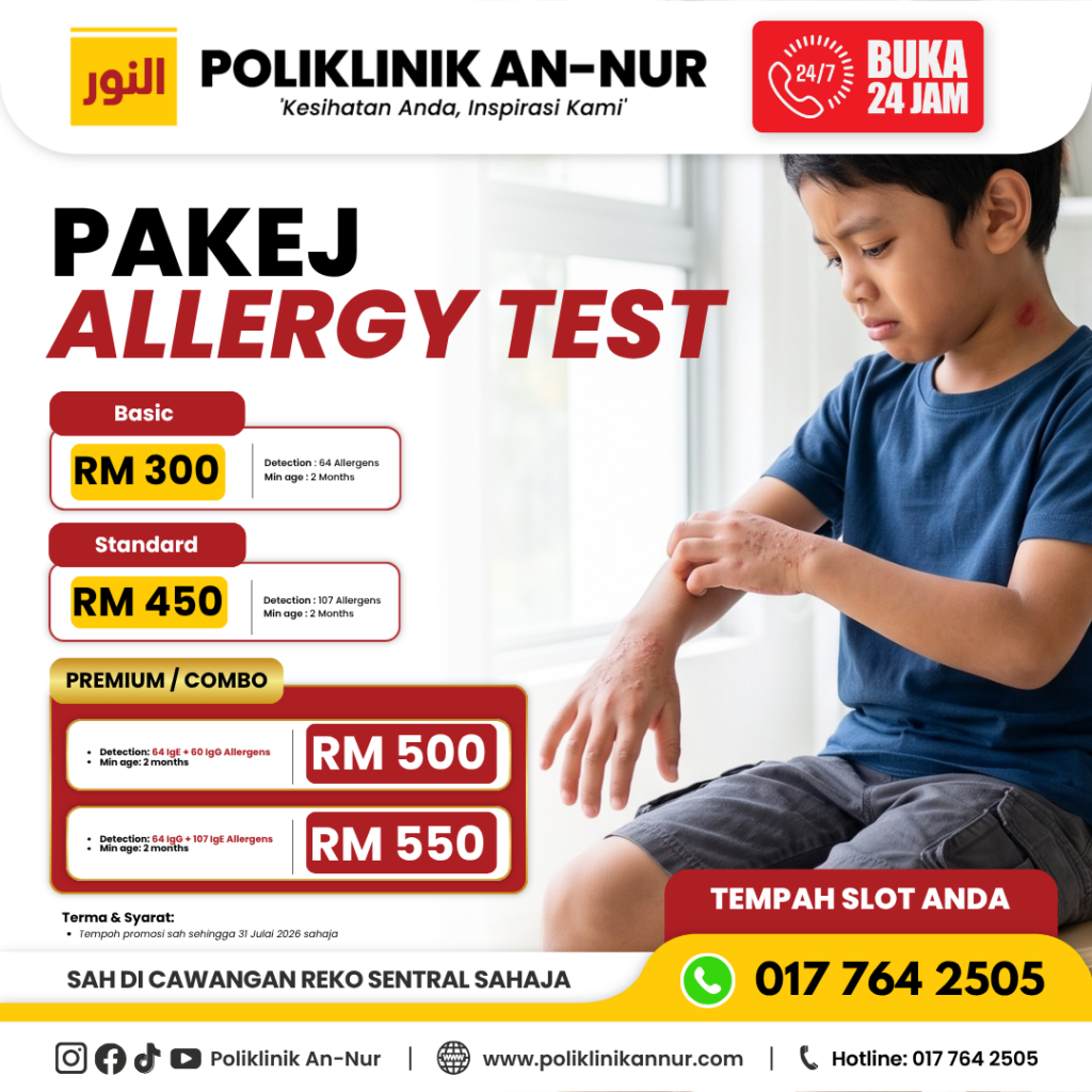 POSTER ADS - 1080x1350 - ALERGIC - NCSB - FON